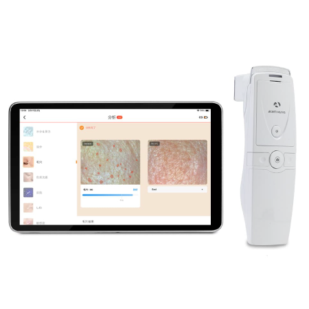 肌カウンセリング API