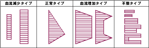 コロトコフ音図